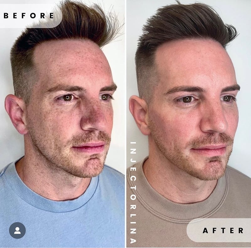 Clear & Brilliant Before & After Image